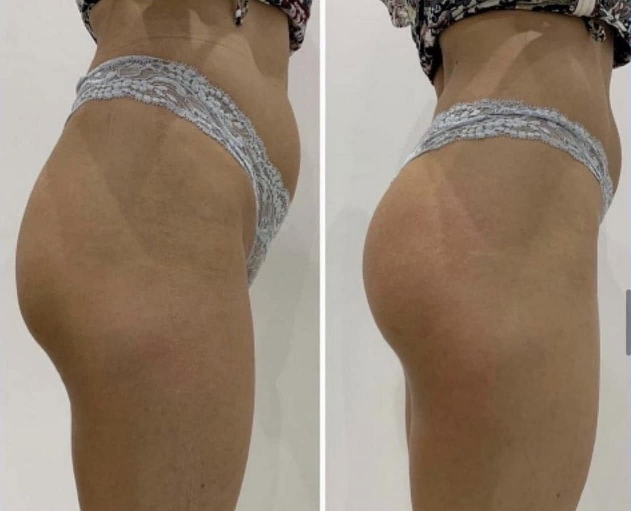 Client before and after