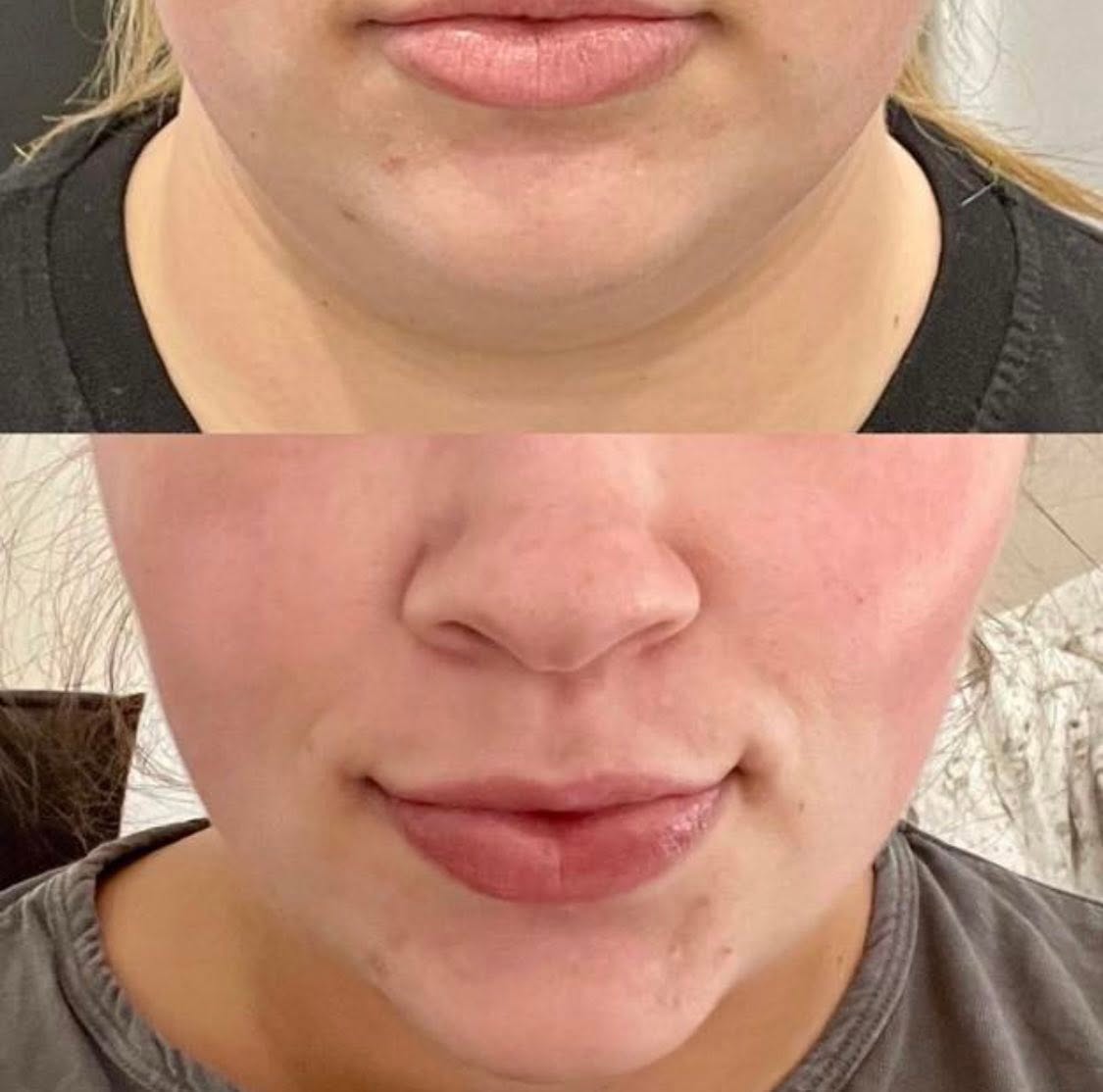 Client before and after