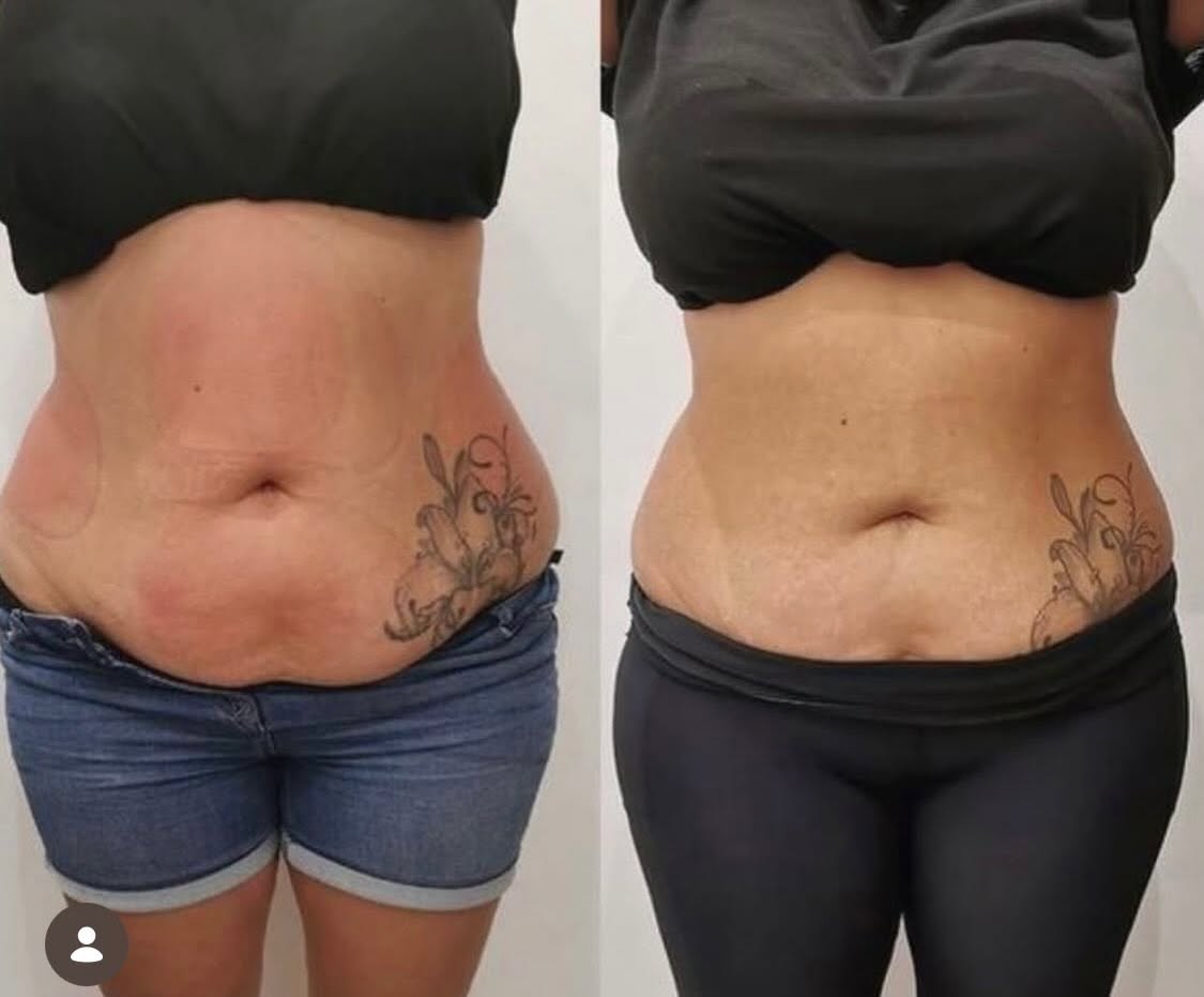 Client before and after