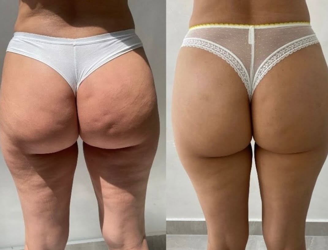 Client before and after