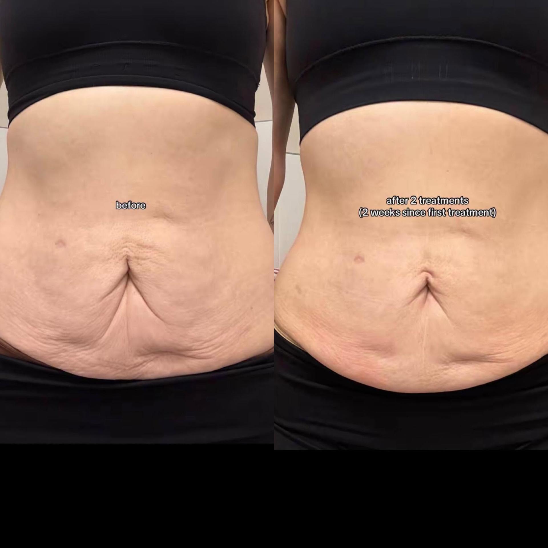 Client before and after