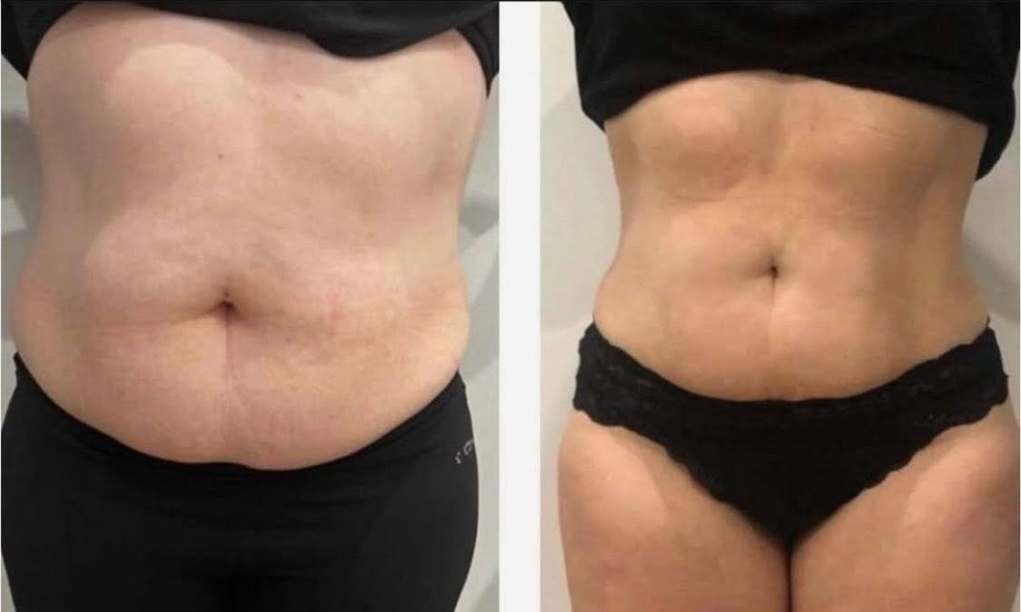 Client before and after