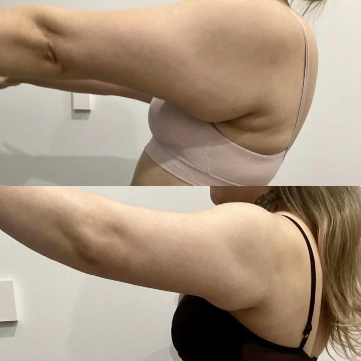 Client before and after